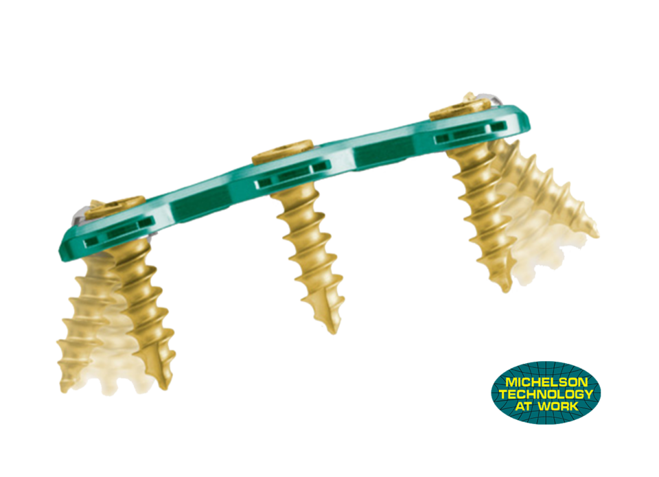 -m-maxan-rg-green-sweep-plate-003-1600x1160-t